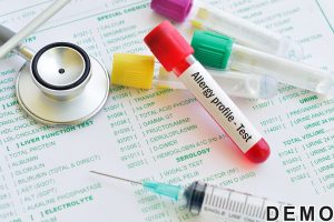 allergy-testing