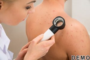 skin-allergy